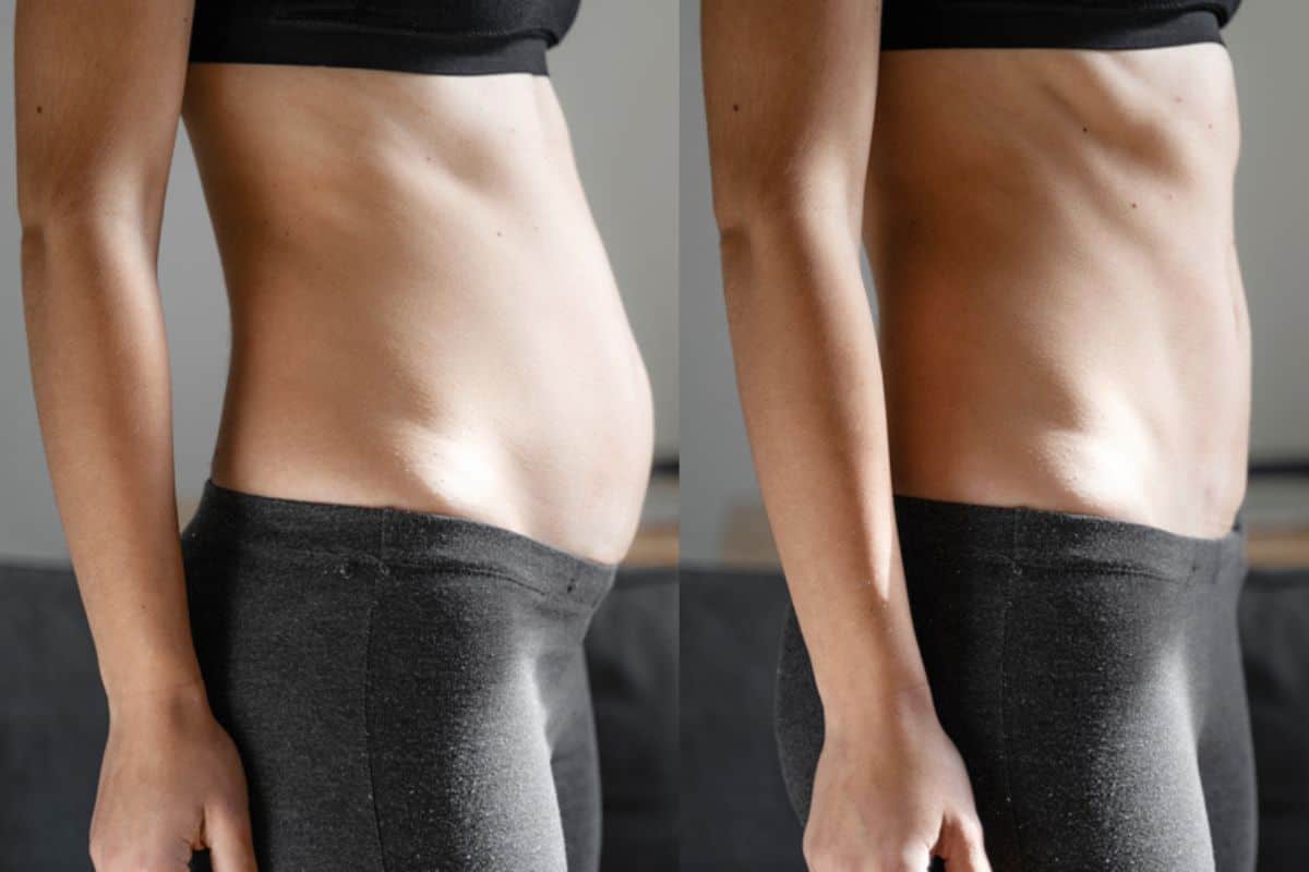 Post-Pregnancy: What Happens to Your Abdominal Muscles After Birth Chingford