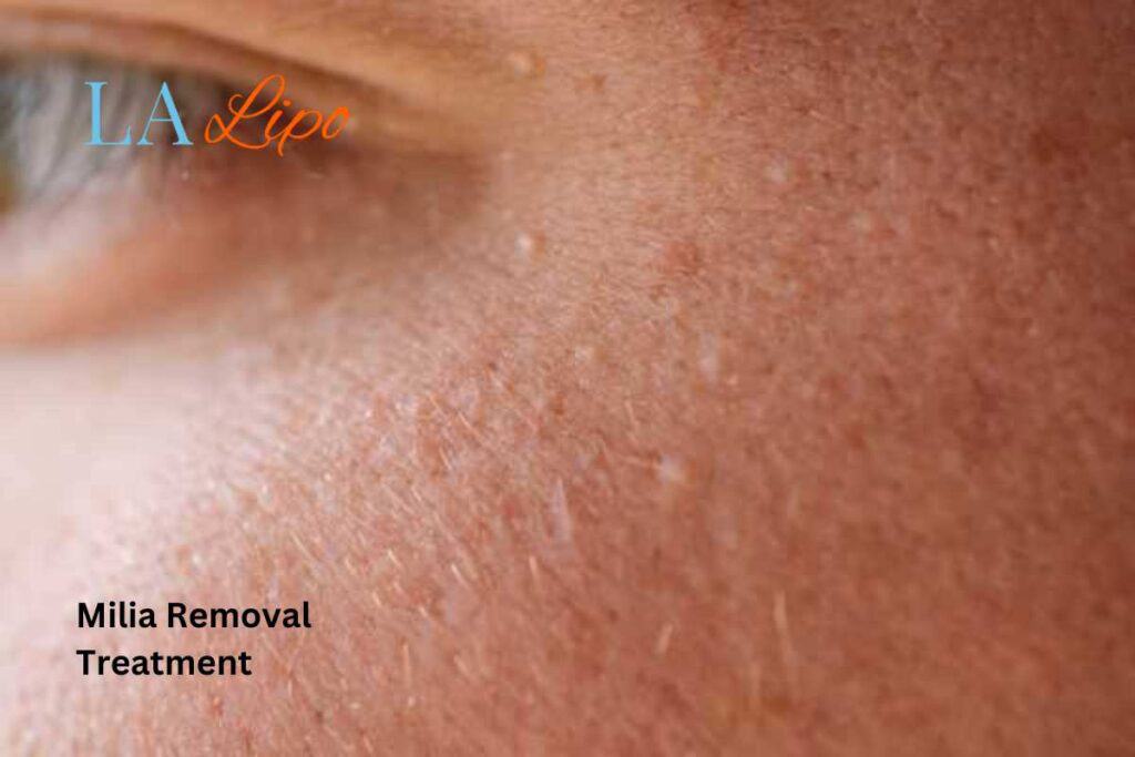When It’s Time to See a Professional Chingford?