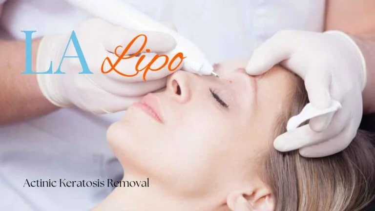 Woman receiving Actinic Keratosis Removal Treatment Chingford