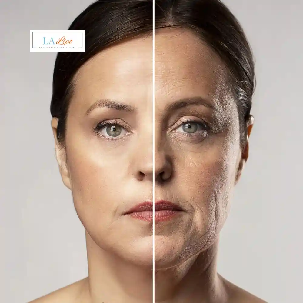How Can You Tell If Non-Surgical Skin Tightening Is Right for You Chingford?