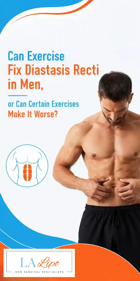 Can Exercise Fix Diastasis Recti in Men, or Can Certain Exercises Make It Worse Chingford?