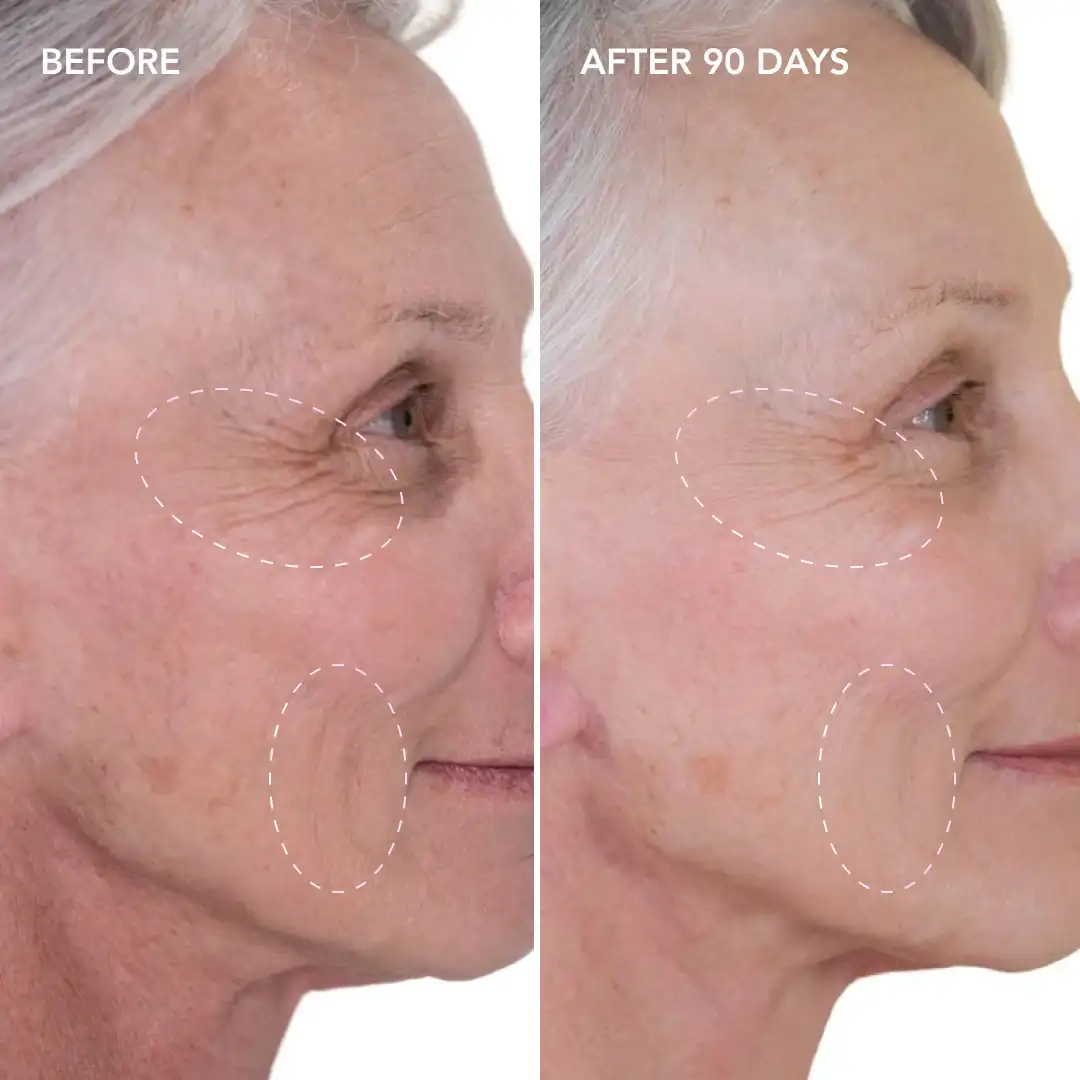 When will you see results Chingford